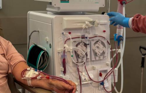 Hemodiálise: O Que É, Como Funciona e Verdades Que Você Precisa Saber