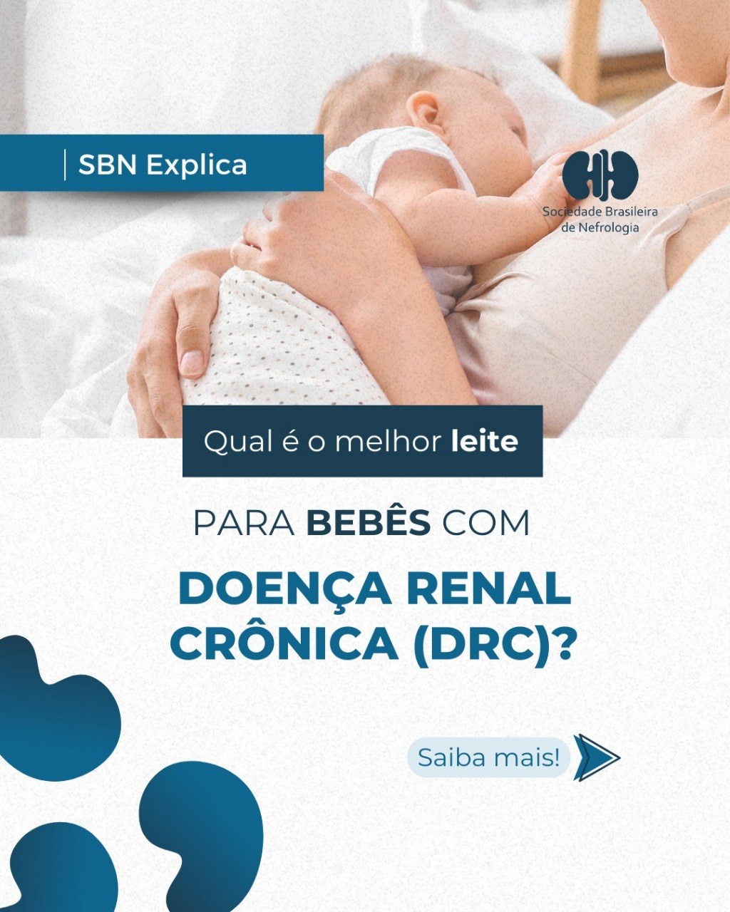 Qual é o melhor leite para bebês com Doença Renal Crônica (DRC)?